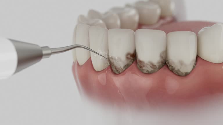 Trusted Dental Crowns And Bridges service in Bowleys Quarters, MD - Dentist Open Now